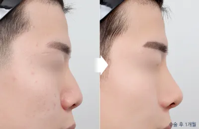 Before & After