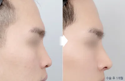 Before & After