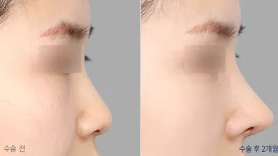 Before & After