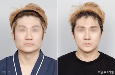 Before & After