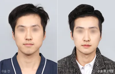 Before & After