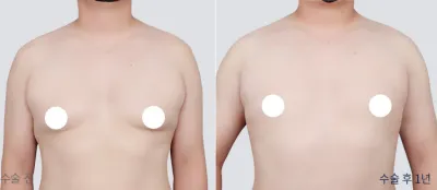 Before & After