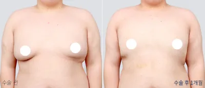 Before & After