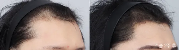 Before/After