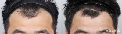 Before & After