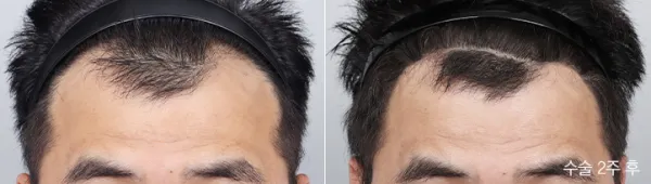 Before/After