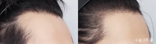 Before/After