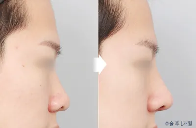 Before & After