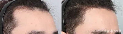 Before & After