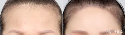 Before & After