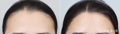 Before & After