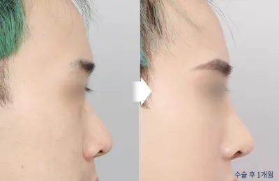 Before & After