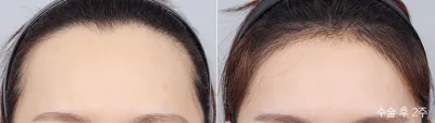 Before & After