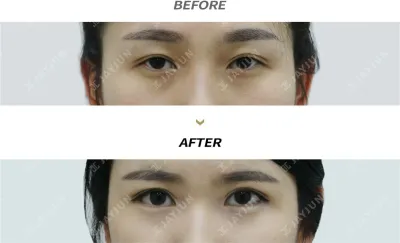 Before & After