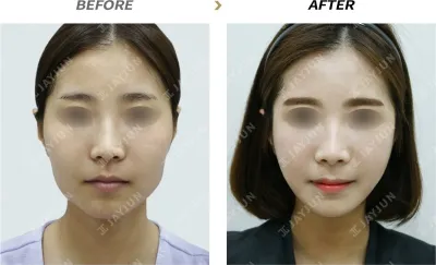 Before & After