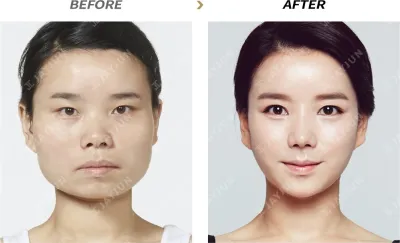 Before & After
