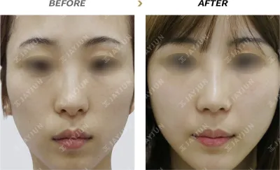 Before & After