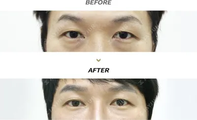 Before & After