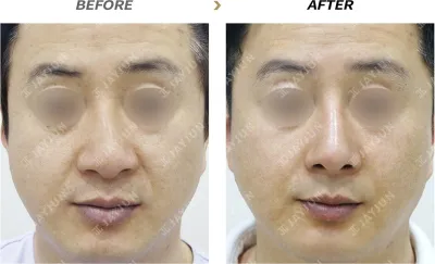 Before & After