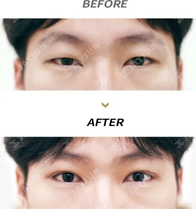 Before & After