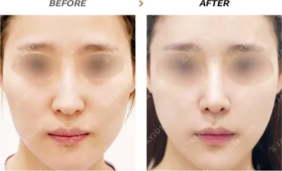 Before & After
