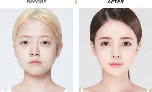 Before/After