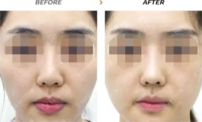 Before & After