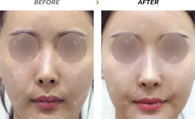 Before & After