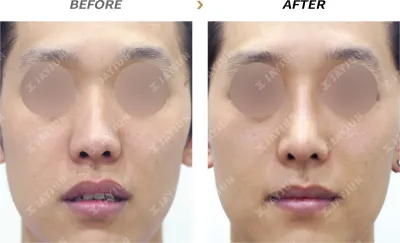 Before & After