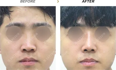 Before & After
