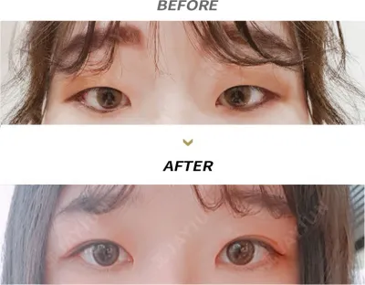 Before & After