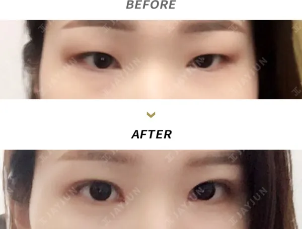 Before/After