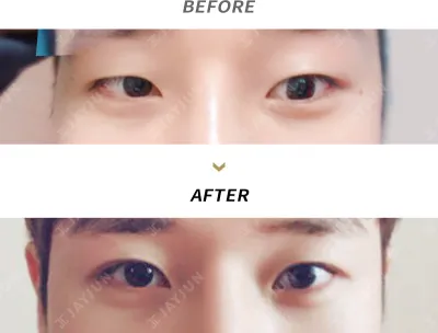 Before & After