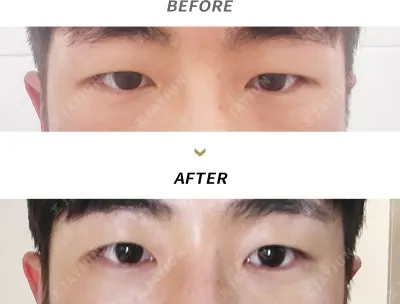 Before & After