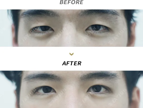Before/After