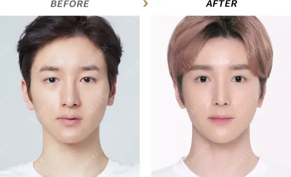 Before/After