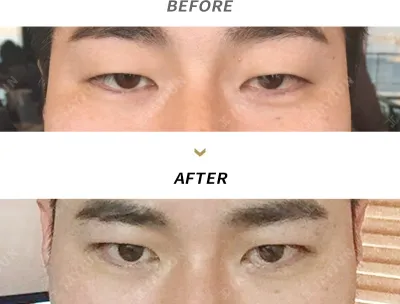 Before & After