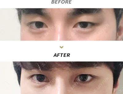 Before & After
