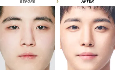 Before & After