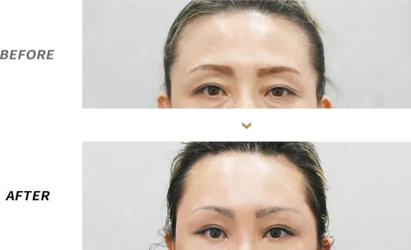 Before/After
