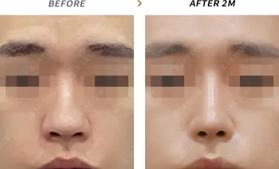 Before & After
