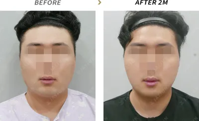 Before & After