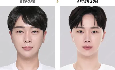 Before & After