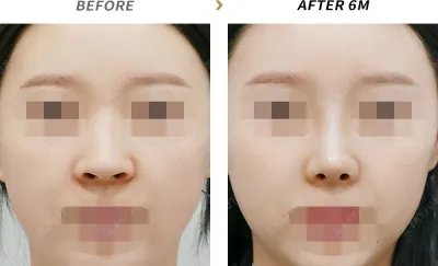 Before & After