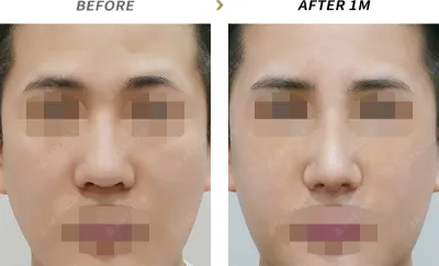 Before & After