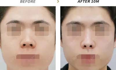 Before & After