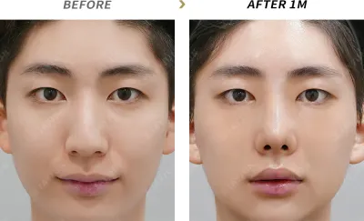 Before & After