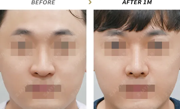 Before/After
