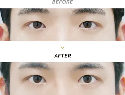 Before & After