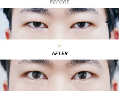 Before & After